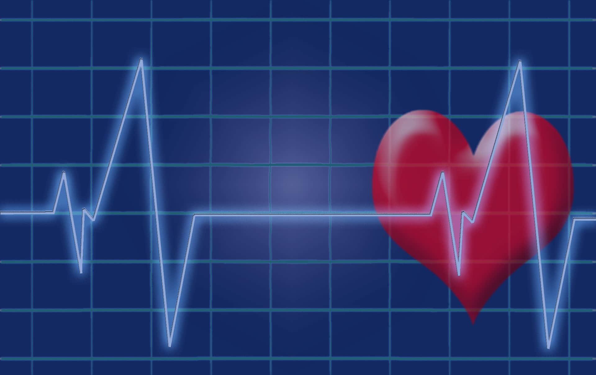 Intellewave and Heart Rate Variability: Applications in Anesthesia